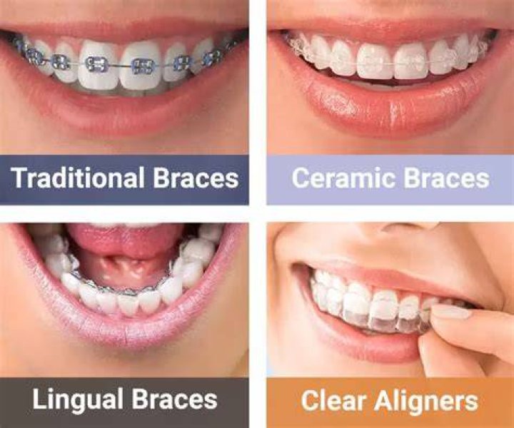 Are ceramic braces more painful?