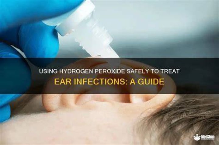 Can you use peroxide for ear infection?