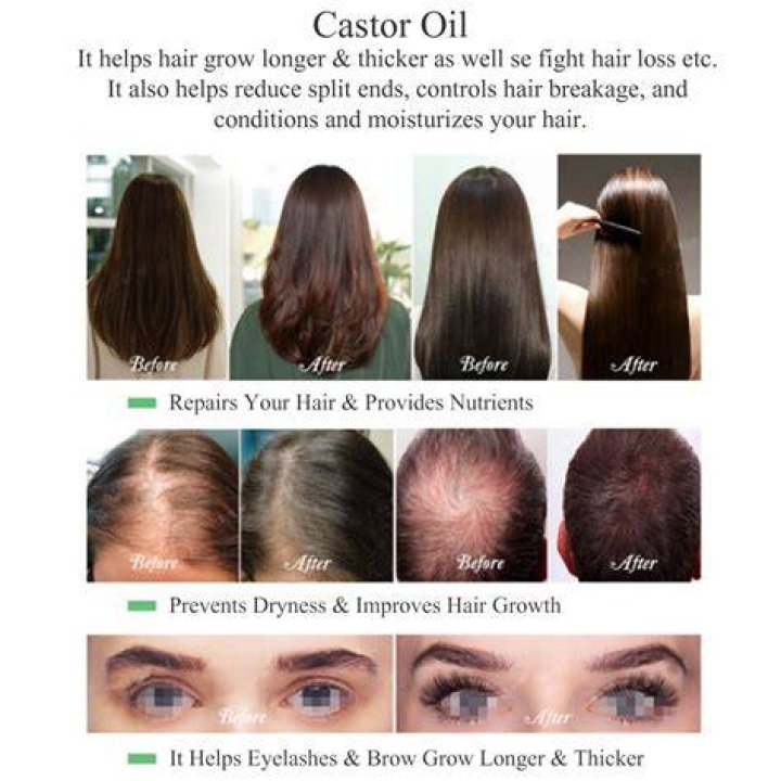 Does castor oil Help HSIR growth?