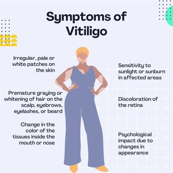 Does vitiligo cause headaches?