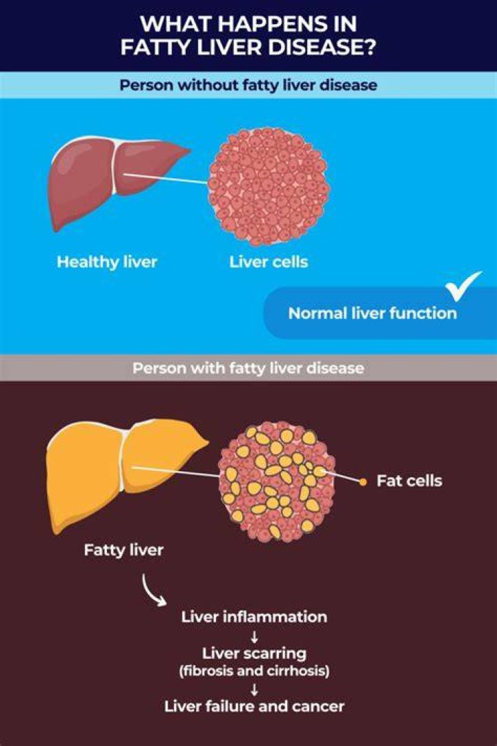 How do you feel with a fatty liver?