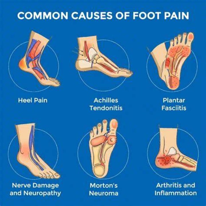 Why do my feet hurt after resting?