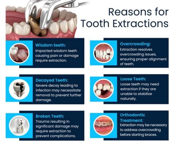 Will extracting a tooth stop the pain?